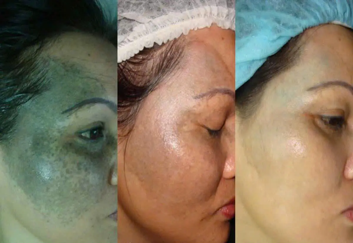 EVER BEAUTÉ CENTER