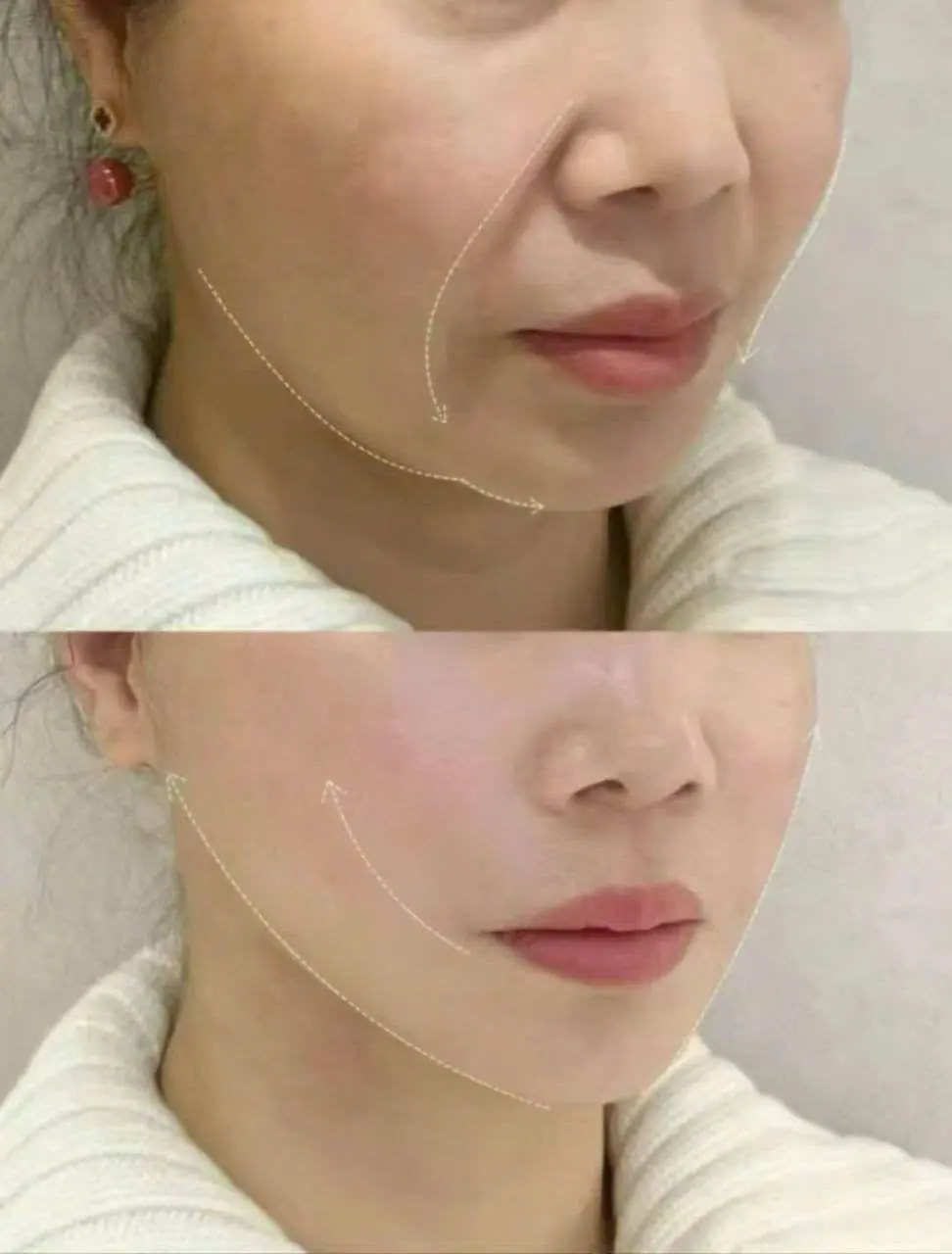 EVER BEAUTÉ CENTER