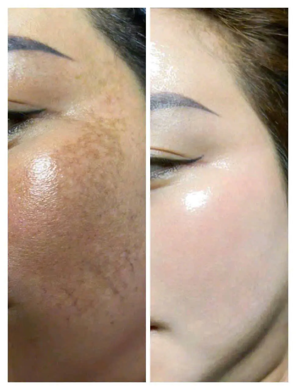 EVER BEAUTÉ CENTER